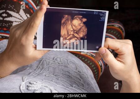 Jeune mère tenant une image 4 d de l'échographie de bébé à naître dans les mains reposant sur un canapé Banque D'Images