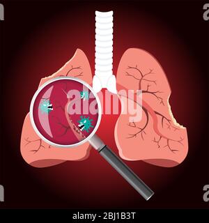 Endommagé par les cellules de Coronavirus avec loupe inspectant les affectés sur le poumon. COVID-19 avec le visage effrayant et mal mangeant le poumon. Concept 2019-nCoV Illustration de Vecteur