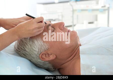 Concept de chirurgie plastique. Mains marquant le visage mâle Banque D'Images