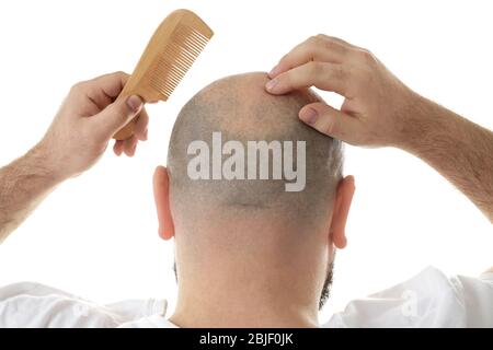 Homme Chauve Avec Le Peigne Concept De Perte Des Cheveux Image stock -  Image du coiffure, regarder: 154286633