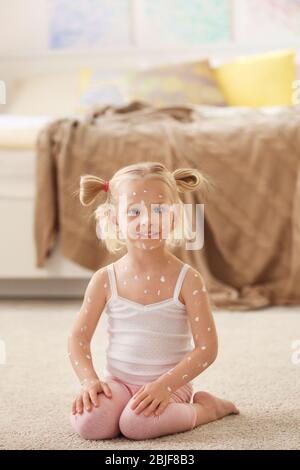 Jolie petite fille avec varicelle à la maison Banque D'Images