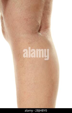 Jambe humaine sur fond blanc, closeup. Concept varices Banque D'Images