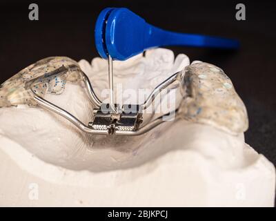 Réglage avec outil de cales palatales sur la copie des dents de gypse. Renforts de développement spéciaux pour la correction du défaut de naissance Banque D'Images