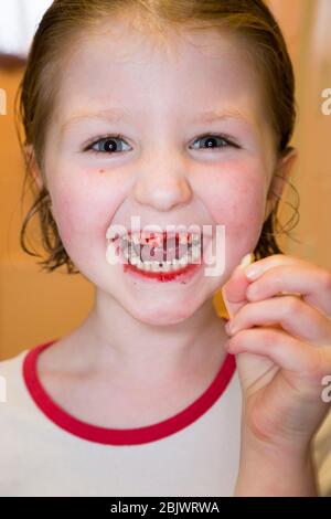 Une petite fille de cinq ans qui est heureuse et ravie, ayant tiré une de ses dents de lait, une incisive de dessus lâche. La plaie est en train de saigner avec du sang pendant un moment après. (119) ROYAUME-UNI Banque D'Images