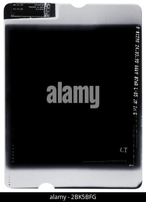 Film radiographique, rayons X. Banque D'Images