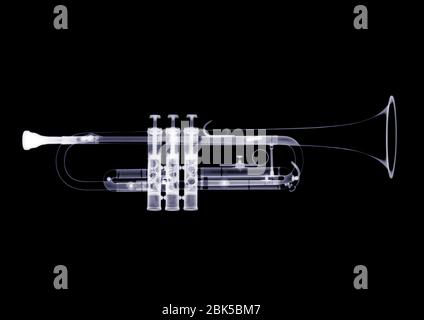 Trompette, rayons X. Banque D'Images