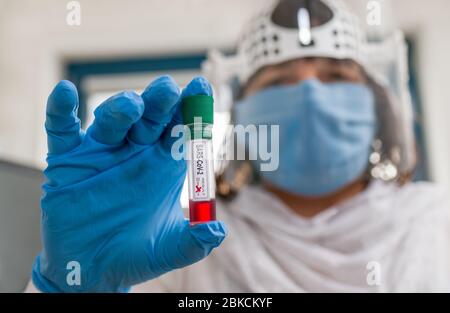 Maladie infectieuse COVID-19. Médecin avec un échantillon de sang de tube à essai SRAS-COV-2. Pandémie mondiale de coronavirus. Assistant de laboratoire dans le masque et le bouclier. Banque D'Images