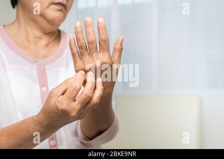 les femmes âgées gratent la main sur le bras de l'eczéma, les soins de santé et le concept de médecine Banque D'Images