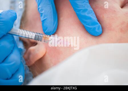 Cosmétologie d'injection. Le médecin fait une injection dans la peau du visage gros plan. Injections anti-âge pour le lifting Banque D'Images