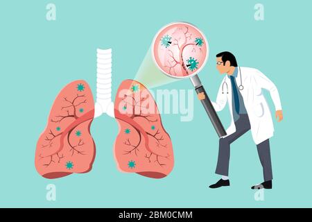 Médecin inspectant le patient affecté sur le poumon par une loupe. Endommagé par les cellules du coronavirus. COVID-19 avec visage effrayant et mal mangeant des poumons. 2019-nCoV c Illustration de Vecteur