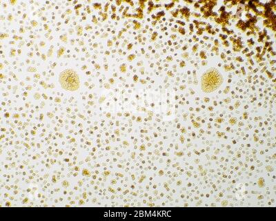 Pholiota sp. Champignon spore imprimé sous le microscope, le champ de vision horizontal est d'environ 0,61mm. Banque D'Images