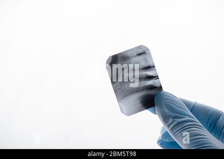 vue rognée du dentiste dans un gant en latex tenant une radiographie des dents sur le blanc Banque D'Images