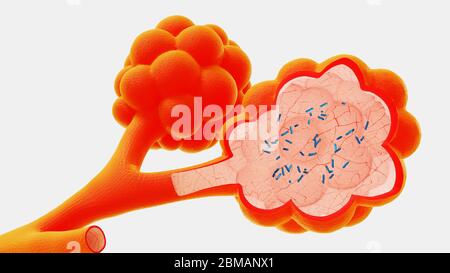 illustration 3d alveoli dans le contexte de la libération de virus et de bactéries Banque D'Images