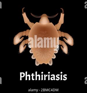 Maladies parasitaires de la phthiriase. Pubis de pédiculose. Structure des poux pubiens. Maladies sexuellement transmissibles. Infographies. Illustration vectorielle activée Illustration de Vecteur