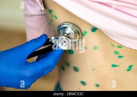 Médecin examinant un enfant avec stéthoscope recouvert de éruptions vertes sur le dos malade avec le virus de la varicelle, de la rougeole ou de la rubéole. Banque D'Images