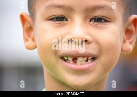 Les dents de bébé sont juste tombé dans la bouche. Banque D'Images