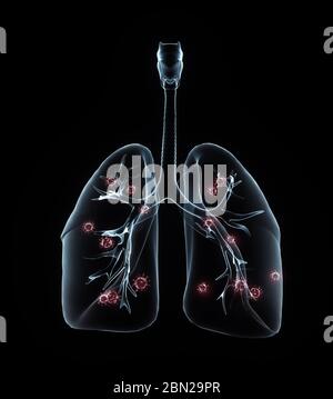 COVID-2019. Hologramme du coronavirus sur fond noir. Virus mortel 2019-nCoV. Modèles 3D système respiratoire. Illustration 3D Banque D'Images