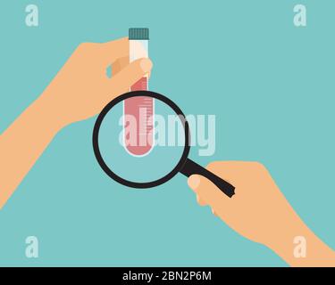 Dessin animé plat illustration de la main scientifique ou médecin avec tube à essai plein de sang pour analyse avec loupe - vecteur Illustration de Vecteur