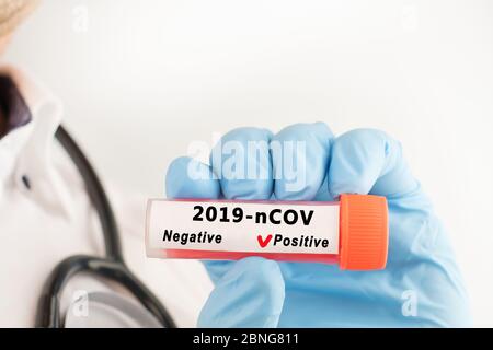 Photographie conceptuelle : une main tient une éprouvette contenant un échantillon de patient qui a été testé positif pour le coronavirus Covid-19 Banque D'Images