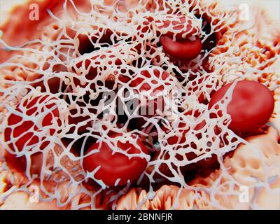 Caillot de sang, illustration. Les globules rouges (érythrocytes) sont piégés dans un filet de protéines de fibrine (blanc). Le maillage de fibrine se forme en réponse à des produits chimiques sécrétés par des plaquettes, des fragments de globules blancs. Des caillots sont formés en réponse à des maladies cardiovasculaires ou à des blessures aux vaisseaux sanguins. Banque D'Images