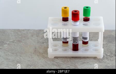 Test pour le coronavirus. Flacon médical avec test sanguin pour le virus COVID-19 Banque D'Images