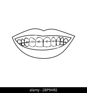 Lèvres souriantes avec dents et bretelles. Contour noir sur fond blanc. L'illustration vectorielle peut être utilisée dans les cartes de vœux, les affiches, les prospectus, les bannières, les promotions, les invitations, etc. EPS10 Illustration de Vecteur