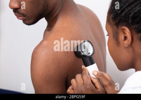 Close-up of a female Doctor Contrôle de la peau pigmentée sur l'homme est de retour avec Dermatoscope Banque D'Images