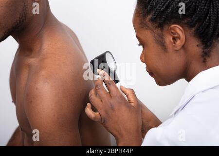 Close-up of a female Doctor Contrôle de la peau pigmentée sur l'homme est de retour avec Dermatoscope Banque D'Images