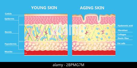 Le schéma d'une peau plus jeune et le vieillissement de la peau montrant la diminution de collagène et élastine cassé dans la peau plus ancienne. Banque D'Images