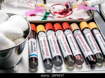 Échantillons de sang pour traiter la maladie de Kawasaki liée au COV-2 du SRAS chez les enfants de moins de cinq ans, image conceptuelle Banque D'Images