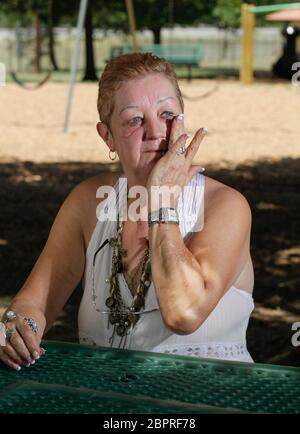 Smithville, Texas, États-Unis. 15 juillet 2011. NORMA MCCORVEY, la femme nommée ''Roe'' dans l'affaire historique de la Cour suprême de 1973 ''Roe vs Wade'' qui protégeait le droit de la femme de choisir l'avortement, pose dans un parc municipal de Smithville, au Texas, le 15 juillet 2011. McCorvey, qui est décédé le 18 février 2017 à Katy, au Texas, affirme dans un nouveau documentaire qu'elle a été payée avec élégance pour inverser sa position sur l'avortement dans les années 90. Crédit : Bob Daemmrich/ZUMA Wire/Alay Live News Banque D'Images