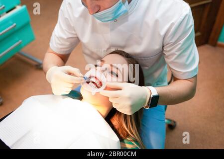 Le patient avec un enrouleur de joue repose sur la chaise dentaire pendant la procédure blanchissant les dents Banque D'Images