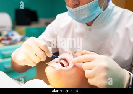 Le patient avec un enrouleur de joue repose sur la chaise dentaire pendant la procédure blanchissant les dents Banque D'Images