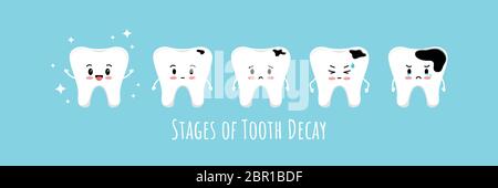 Étapes de l'ensemble d'icônes de carie dentaire emoji. Dents de kawaii mignonnes sur les différentes étapes du développement de caries dentaires. Illustrateur vectoriel de personnage emoji de dessin animé plat Illustration de Vecteur