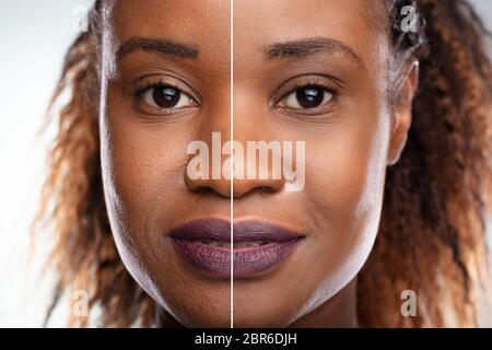 Close-up of a young woman's Face avant et après intervention cosmétique Banque D'Images