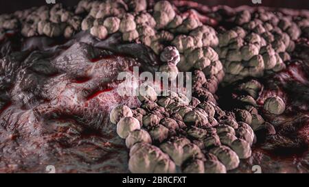 Science photo de bactéries Candida albicans est une levure pathogène opportuniste qui est un membre commun de la flore intestinale humaine Banque D'Images