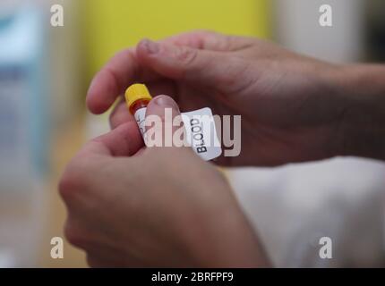 Katy Peters, de la clinique de vaccination de Londres, avec un échantillon de sang après avoir effectué un test à domicile des anticorps IgG contre le COV-SRAS, à Notting Hill, Londres, alors que le Royaume-Uni continue à se maintenir en isolement pour aider à freiner la propagation du coronavirus. Banque D'Images