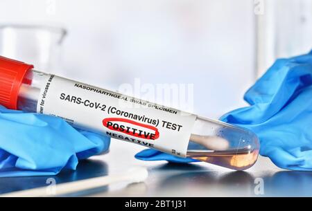 Concept de test du coronavirus - tube d'échantillonnage en flacon avec écouvillon en coton, mot positif entouré d'un équipement de laboratoire rouge, flou et fond bleu de gants en nitrile. Banque D'Images