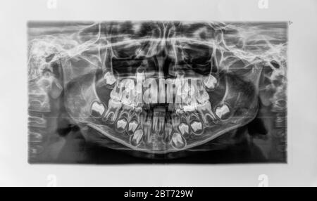 Vue panoramique des dents des enfants. Foyer sélectif. Enfant. Banque D'Images