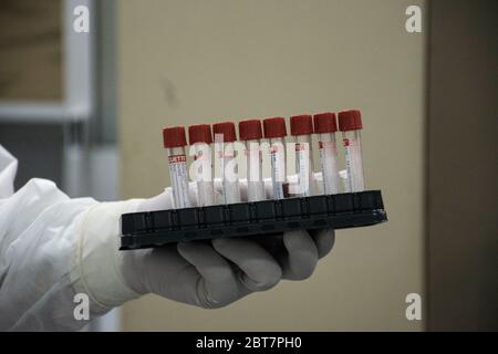 Giza, Égypte. 21 mai 2020. Une photo mise à disposition le 23 mai 2020 montre un écouvillon d'analyse médique prélevé chez des patients suspectés d'avoir contracté le coronavirus à l'hôpital central du 6 octobre, qui a été transformé en hôpital d'isolement pour les patients atteints de COVID-19. Crédit : Menna Hossam/dpa/Alay Live News Banque D'Images