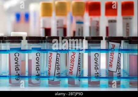 Flacons contenant des échantillons de SARS-COV-2 Covid-19 dans un laboratoire de recherche, image conceptuelle Banque D'Images