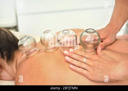 Jeune physiothérapeute femme appliquant des ventouses de verre sur l'arrière de sa patiente, pendant la thérapie de cupping, détail de gros plan Banque D'Images