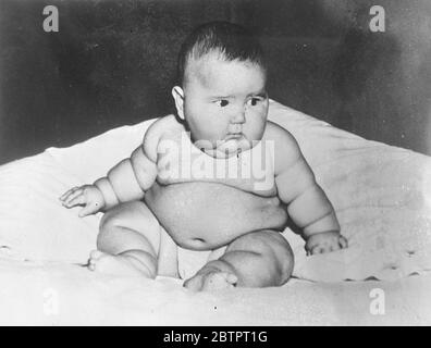 Le Bebe Rebondissant Du Kentucky Six Mois Pese 40 Livres Gagne Chaque Mois Bien Qu Une Taille Et Un Poids Normaux A La Naissance Il Y A Six Mois Lambert Ballard Alsip A 2 Pieds De Hauteur Pese 40 Livres Et Gagne Du Poids Au Rythme De 3 Livres