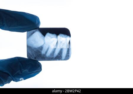 Rayons X des dents de sagesse dans les mains du dentiste Banque D'Images