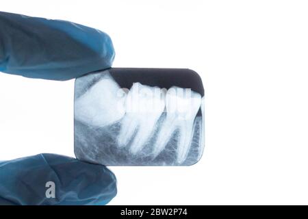 Rayons X des dents de sagesse dans les mains du dentiste Banque D'Images