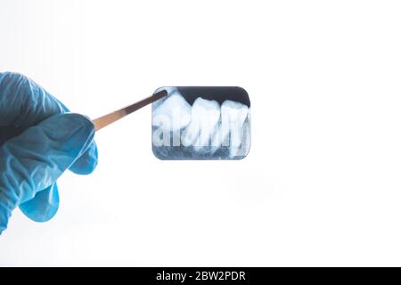 Rayons X des dents de sagesse dans les mains du dentiste Banque D'Images