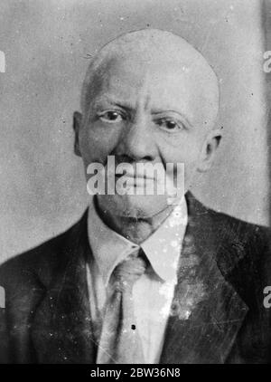 L'homme devient blanc après avoir pris les pilules du médecin sorcière . Ysemeond Dauphin , un homme de 57 ans originaire d'Haïti , a avalé des pilules qui lui ont été données pour l'asthme par un médecin sorcière et après avoir été aveugle pendant plusieurs mois sa peau ébène a tourné blanc rose . Ses cheveux et cils se sont également tournés en blanc . Les pilules ont été trouvés pour contenir un acide cyanidique . leur curieux effet est étudié par les médecins principaux en Amérique . Photo shows , Ysmeond Dauphin , l'homme qui a tourné blanc à New York en route vers le congrès médical de Chicago à examiner par les médecins . 28 juin 1933 Banque D'Images