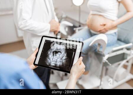 Médicaments avec échographie d'un enfant à naître sur un comprimé numérique pendant un examen avec une femme enceinte au bureau, vue rognée sans visage Banque D'Images