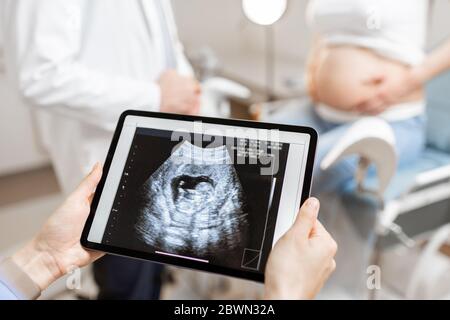 Médicaments avec échographie d'un enfant à naître sur un comprimé numérique pendant un examen avec une femme enceinte au bureau, vue rognée sans visage Banque D'Images