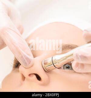 Traitement de la micrométologie de dermbraation. Gommage du visage au diamant. Procédure anti-acné. Mains de femme et de médecin. Articles médicaux Banque D'Images